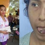 Intentan cortar lengua a mujer trans en Oaxaca